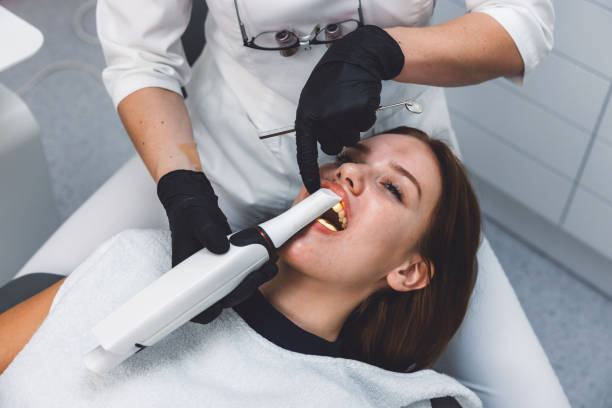 Best Emergency Wisdom Tooth Extraction in Lynnville, IN